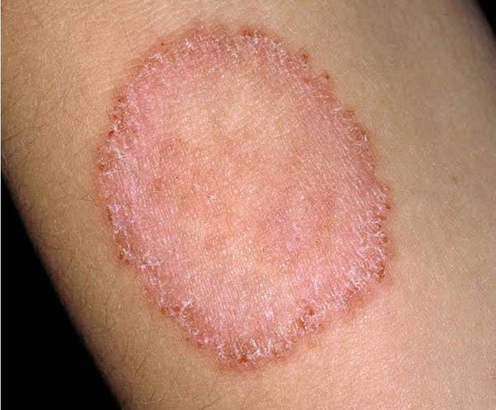 Dermatology and general skin disease treatment
