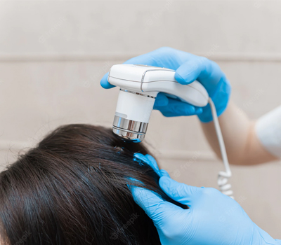 Hair restoration procedure